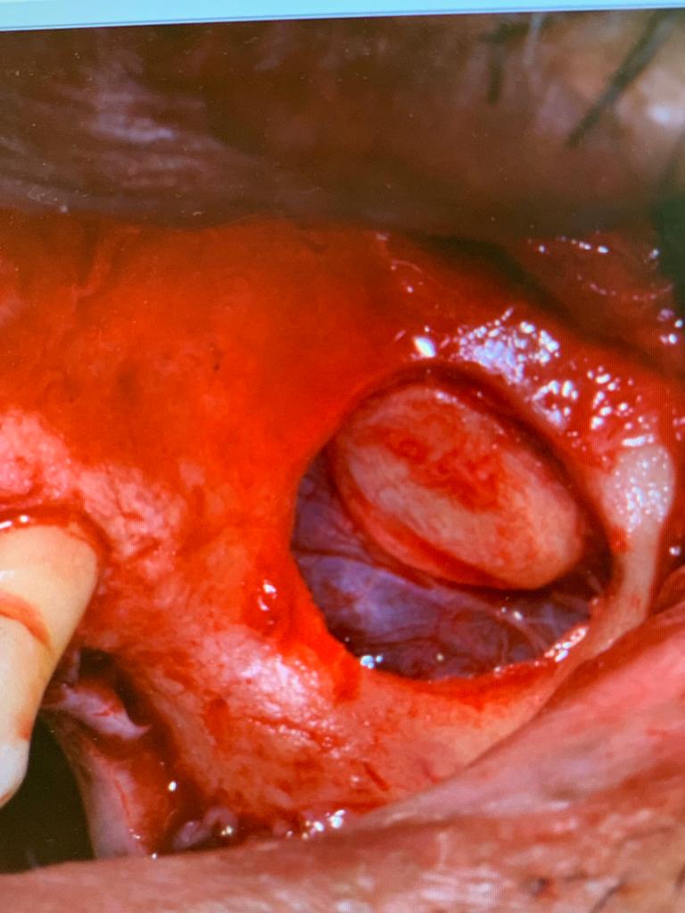 Photo 2019 07 11 17 00 57 4