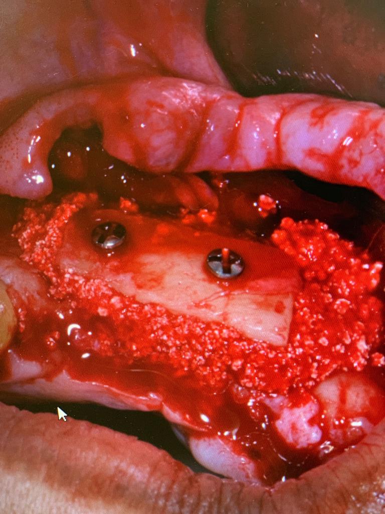 Photo 2019 07 11 17 00 56