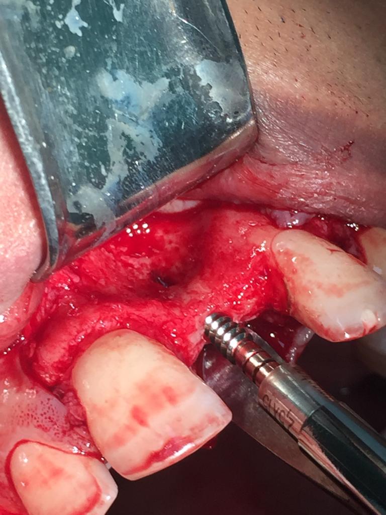 Photo 2019 09 11 07 41 04