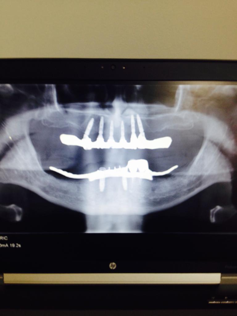 Photo 2019 09 11 07 53 28 4