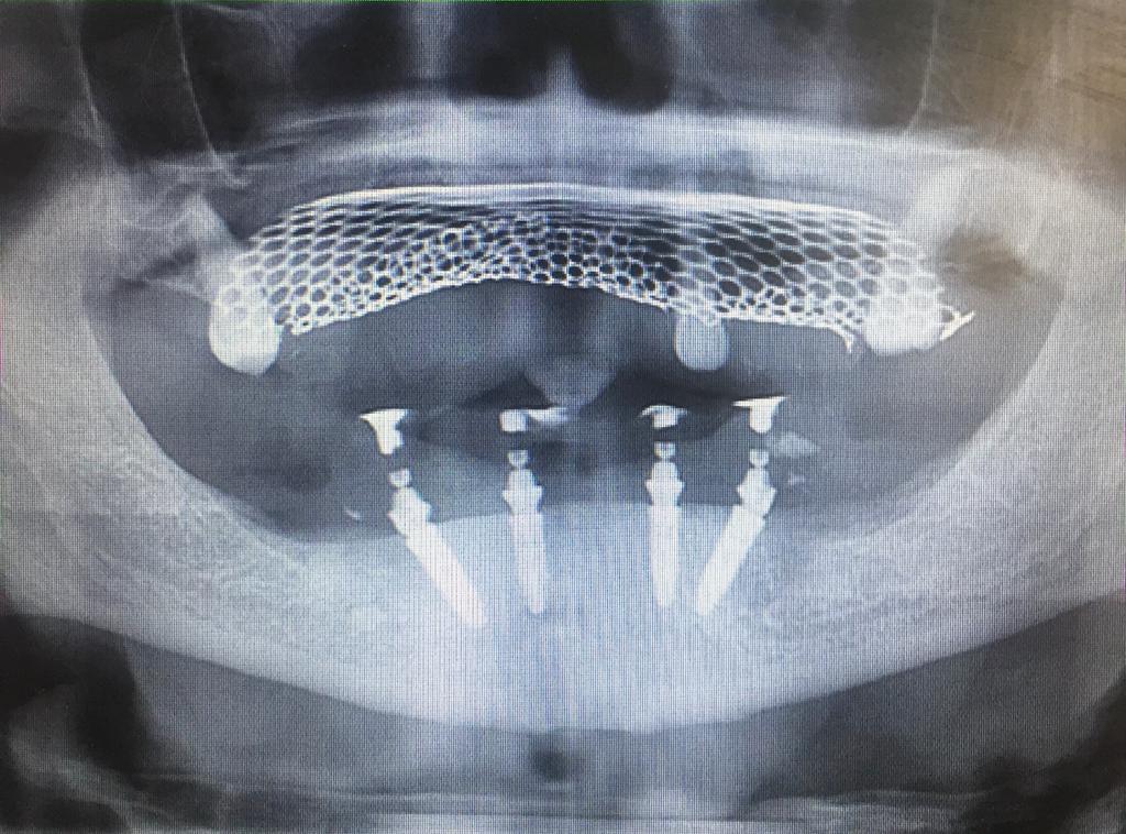 Photo 2019 09 11 07 45 14 1 