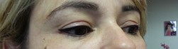 Liner 1 b