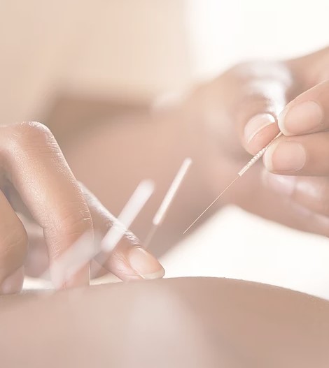 Cécile Chabot , Lyon Acupuncture, vous propose des soins d'acupuncture dans le cabinet d'Acupuncture situé au cœur du 1er arrondissement de Lyon, dans les pentes de la Croix Rousse.


