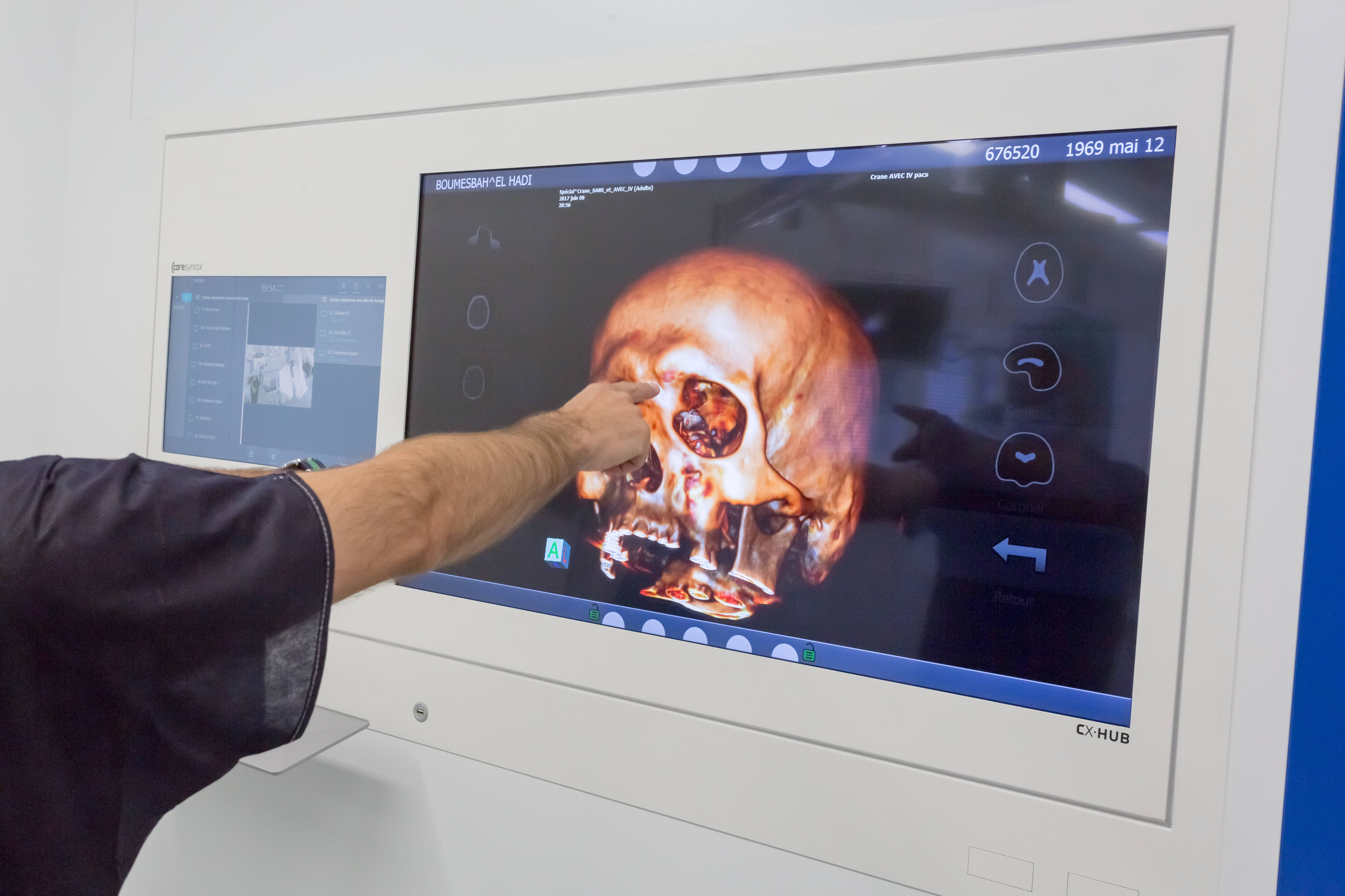 Photos a l hopital marie lannelongue 36 sur 66 