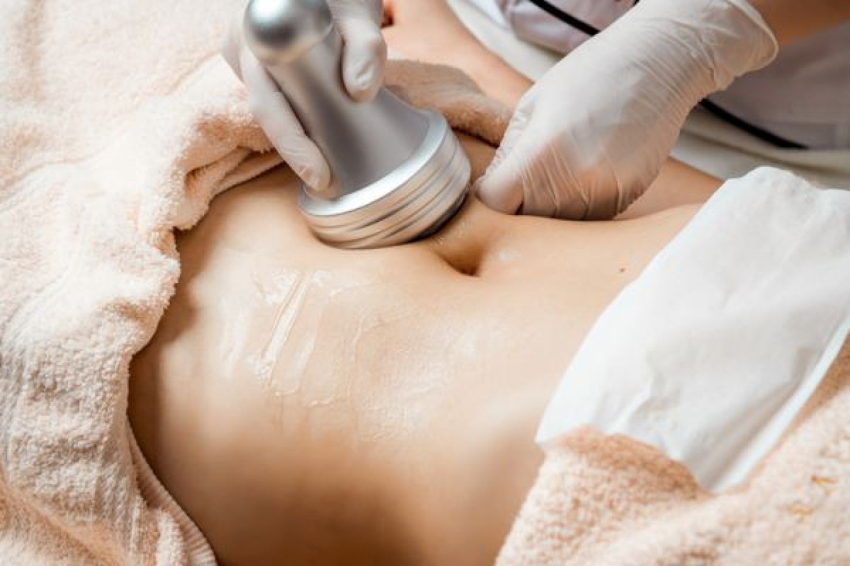 Lipo Cavitation: alternative a la liposuccion