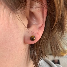 Puces-oreilles-oeil-tigre-institut-reverie-energie-vitale