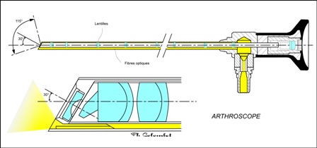Arthroscope Philippe Colombet web-bbc6f