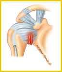 Capulisite-retractile-beed6