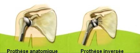 Schema 2 pte-8261f