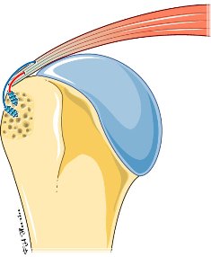Suture4 web-96f5d