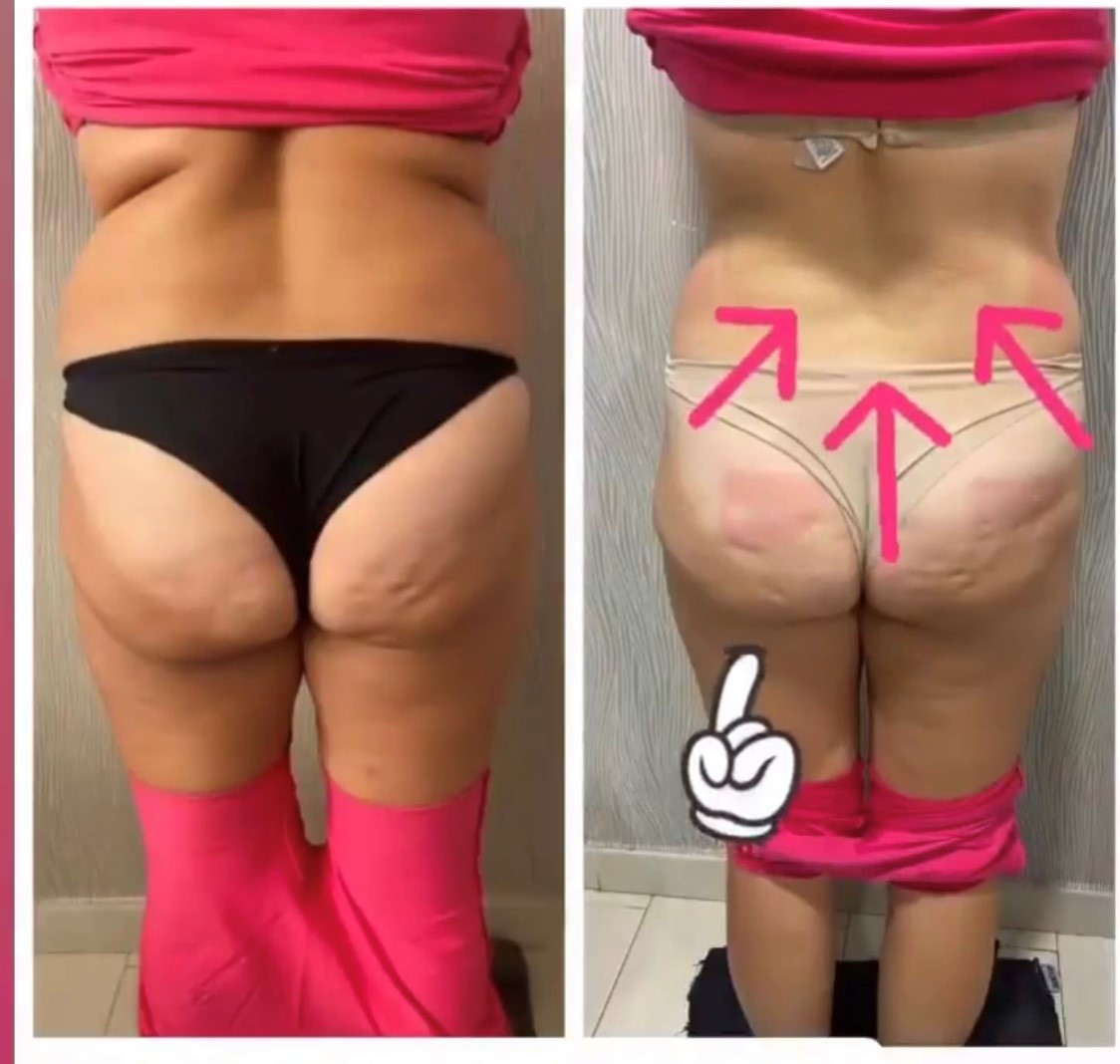 32