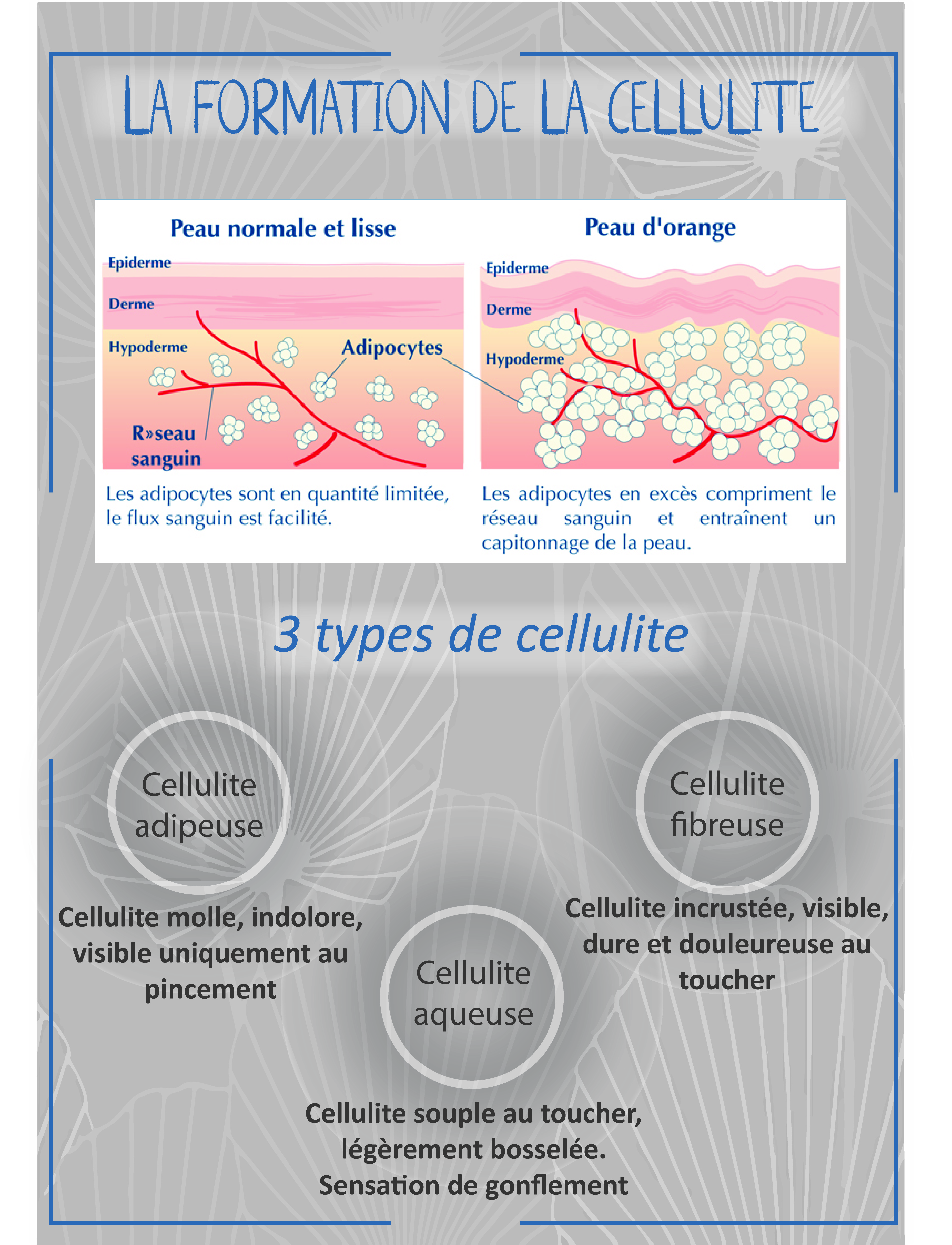 Affiche-formation-de-la-Cellulite