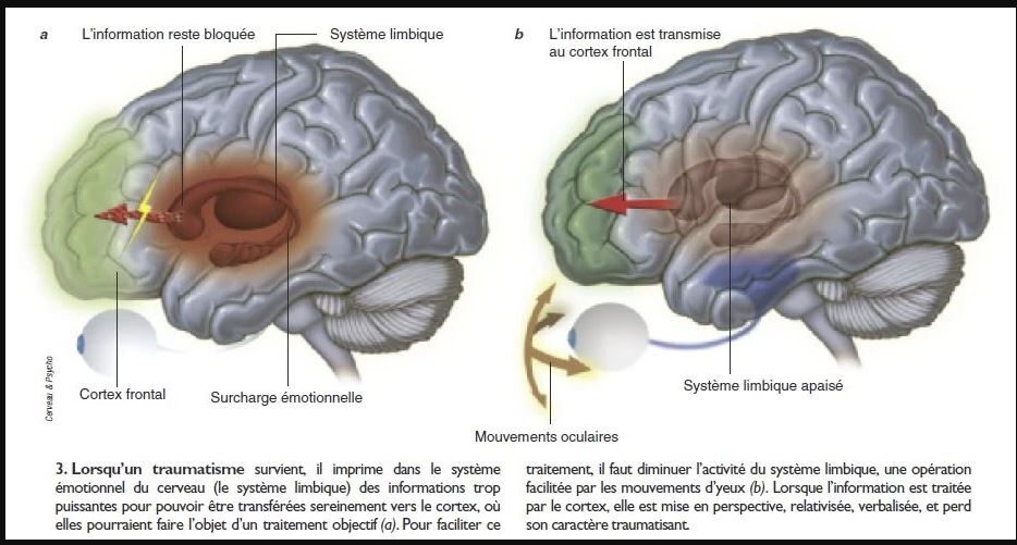 EMDR-Cerveau-et-psycho