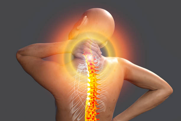 Fibromialgie
