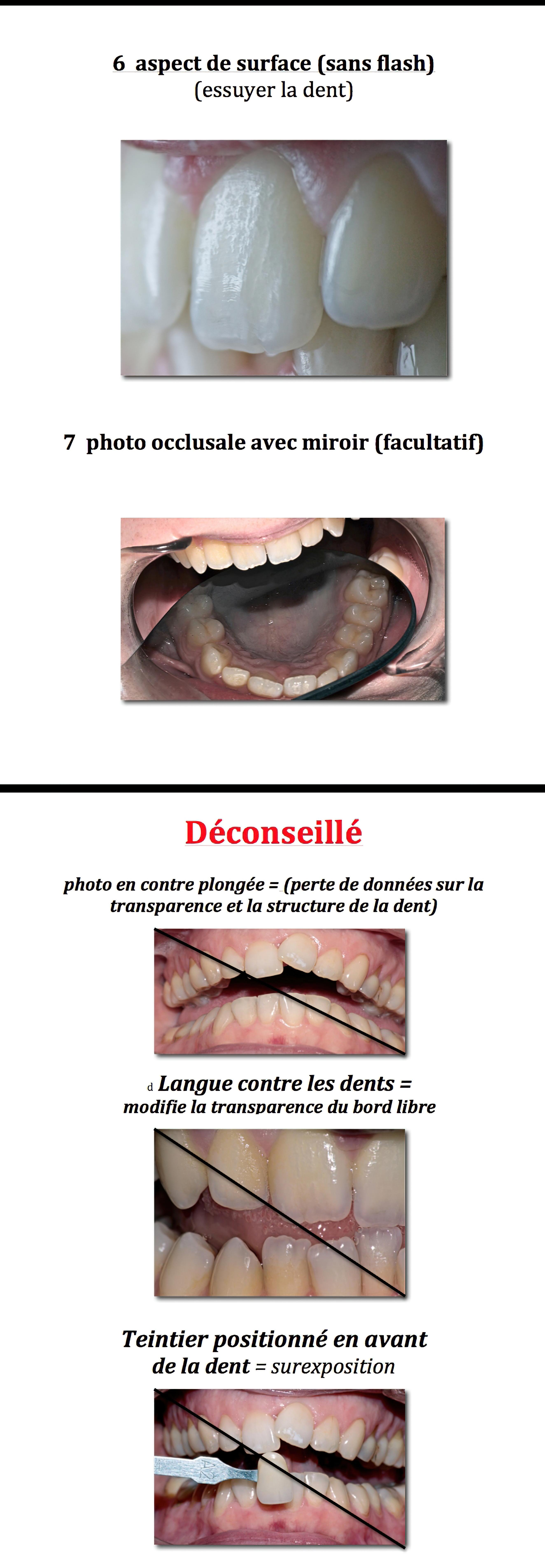 Re-ussir-les-photos-dentaires-gigapixel-standard-scale-4 00x-2