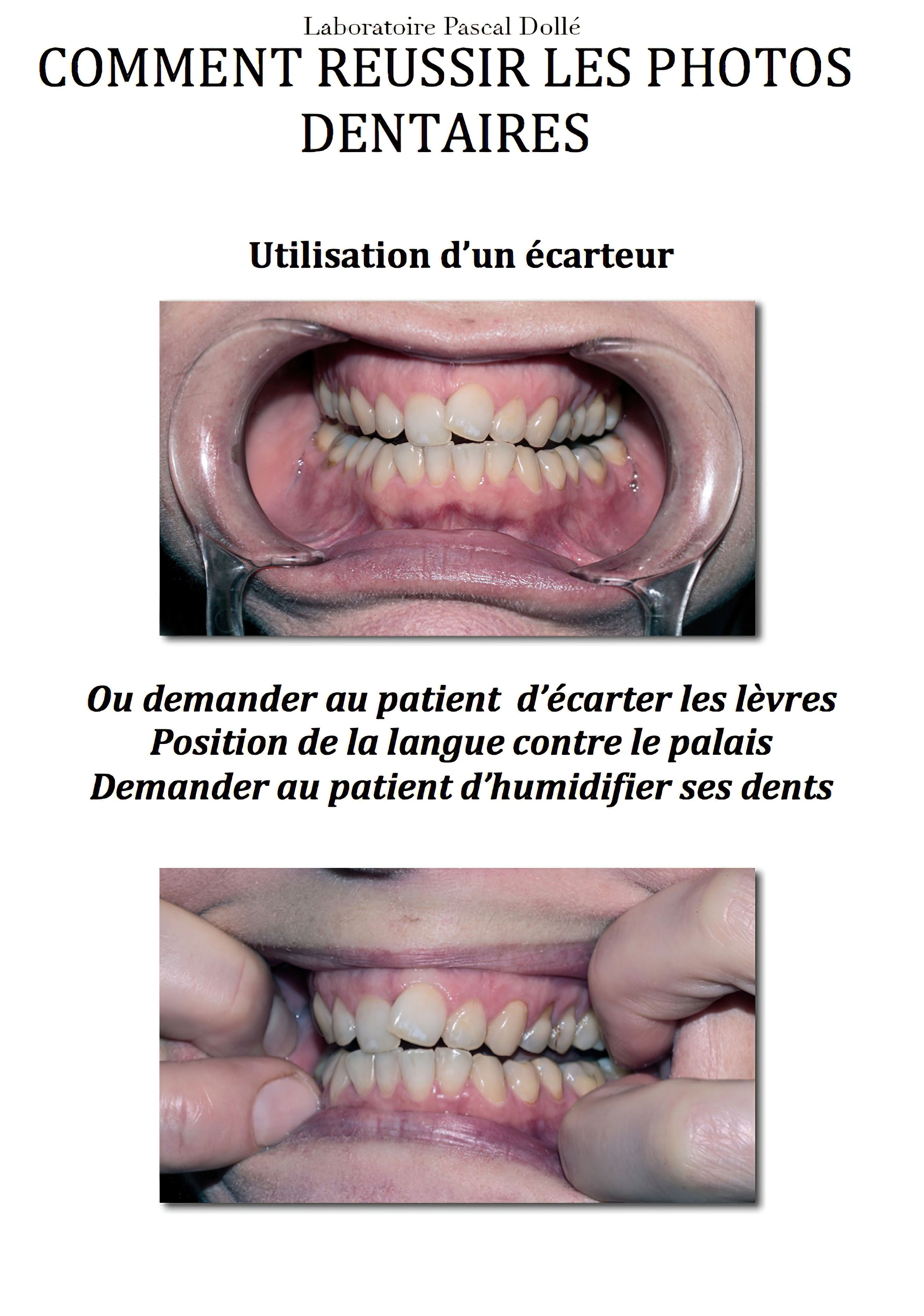 Re-ussir-les-photos-dentaires-gigapixel-standard-scale-4 00x-4