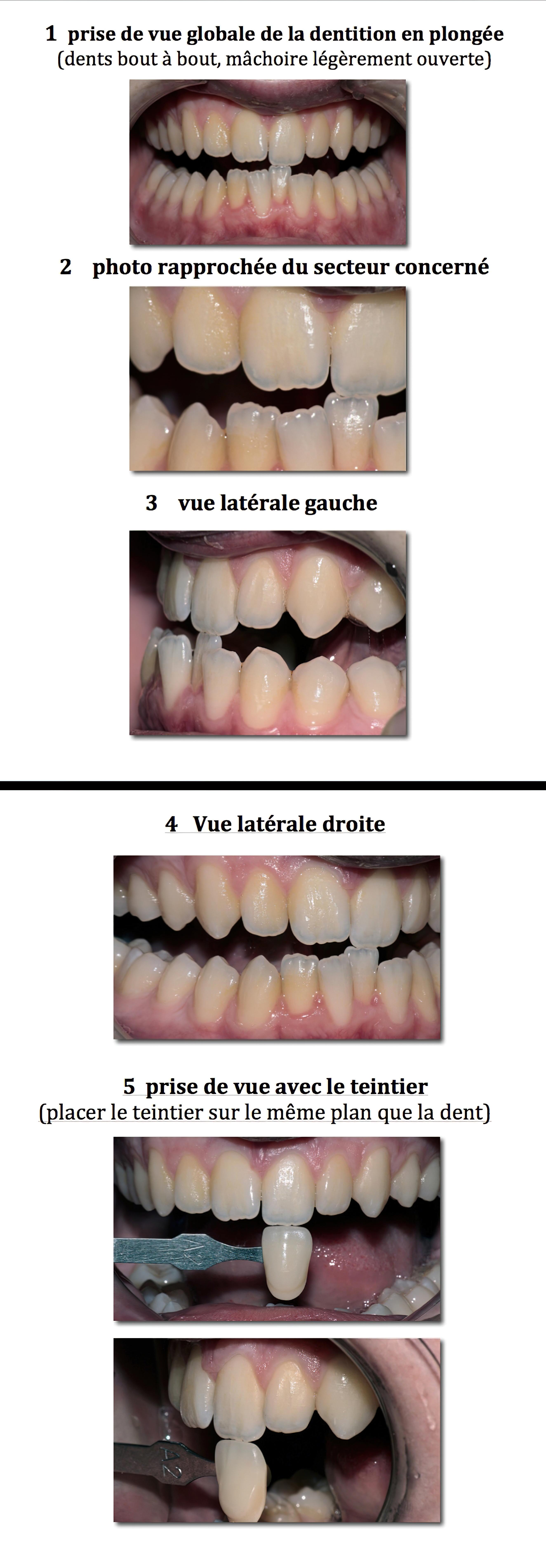 Re-ussir-les-photos-dentaires-gigapixel-standard-scale-4 00x-3
