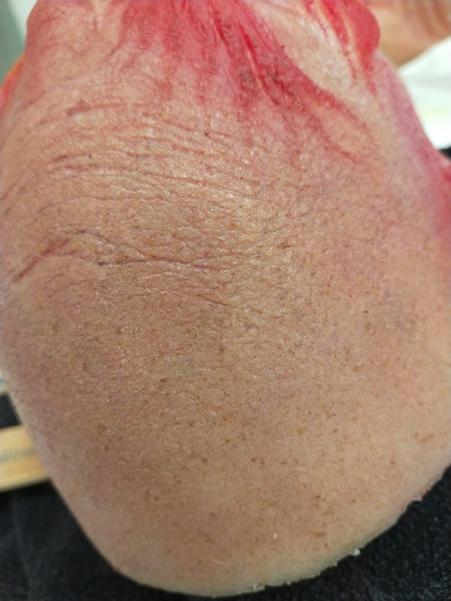 102763325 10216396950052928 6519945051806629888 n