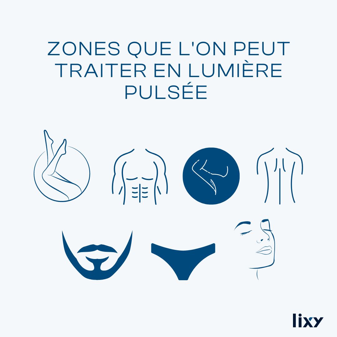 Epilation Lumière Pulsée