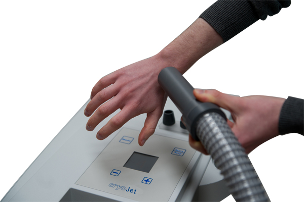 Cryotherapie