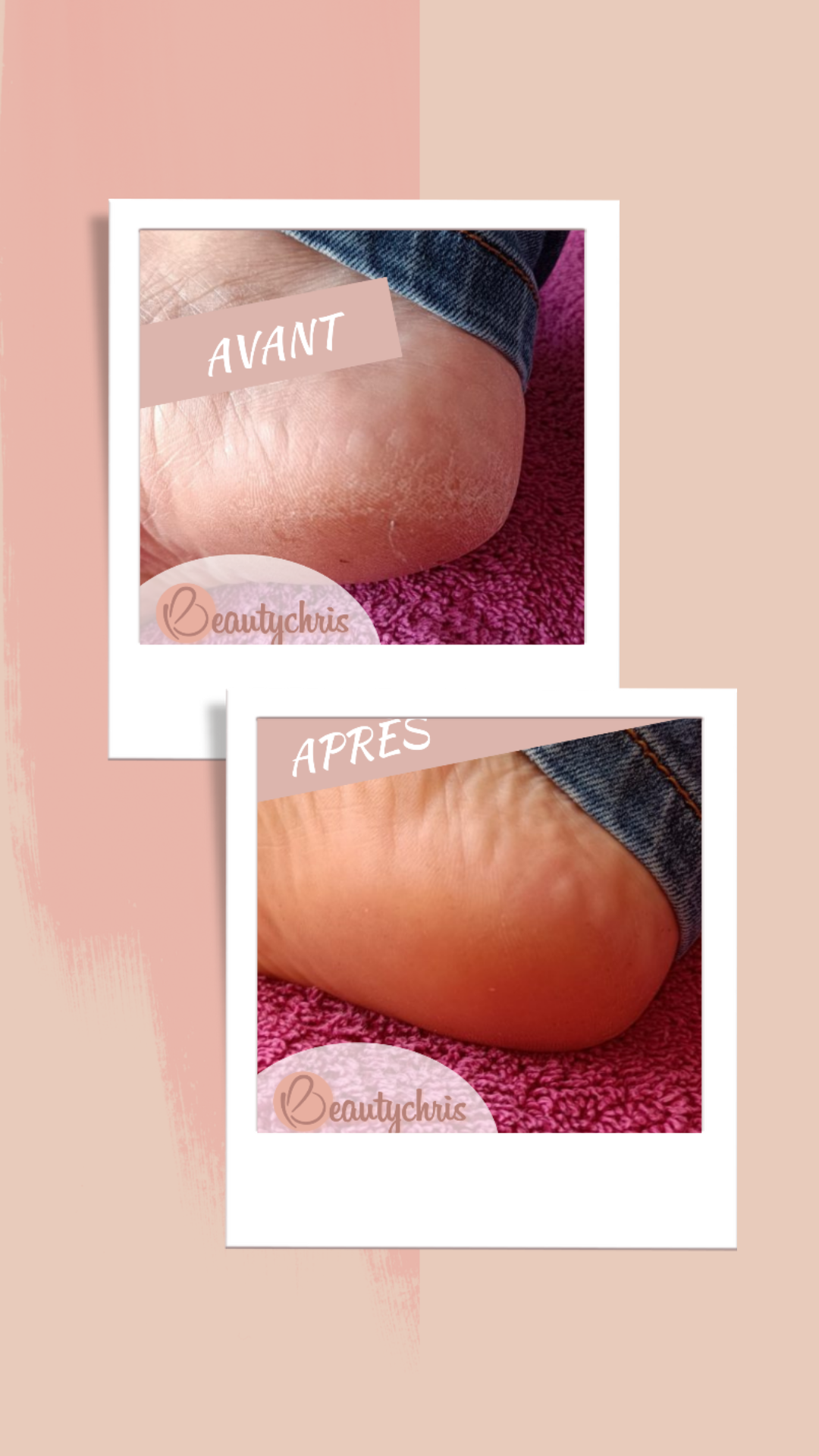 Pieds-3