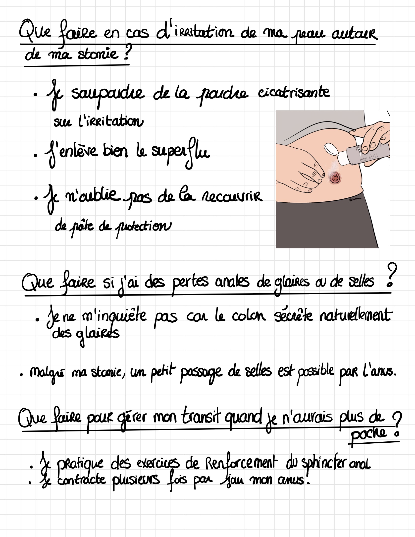 Livret ile ostomie 16