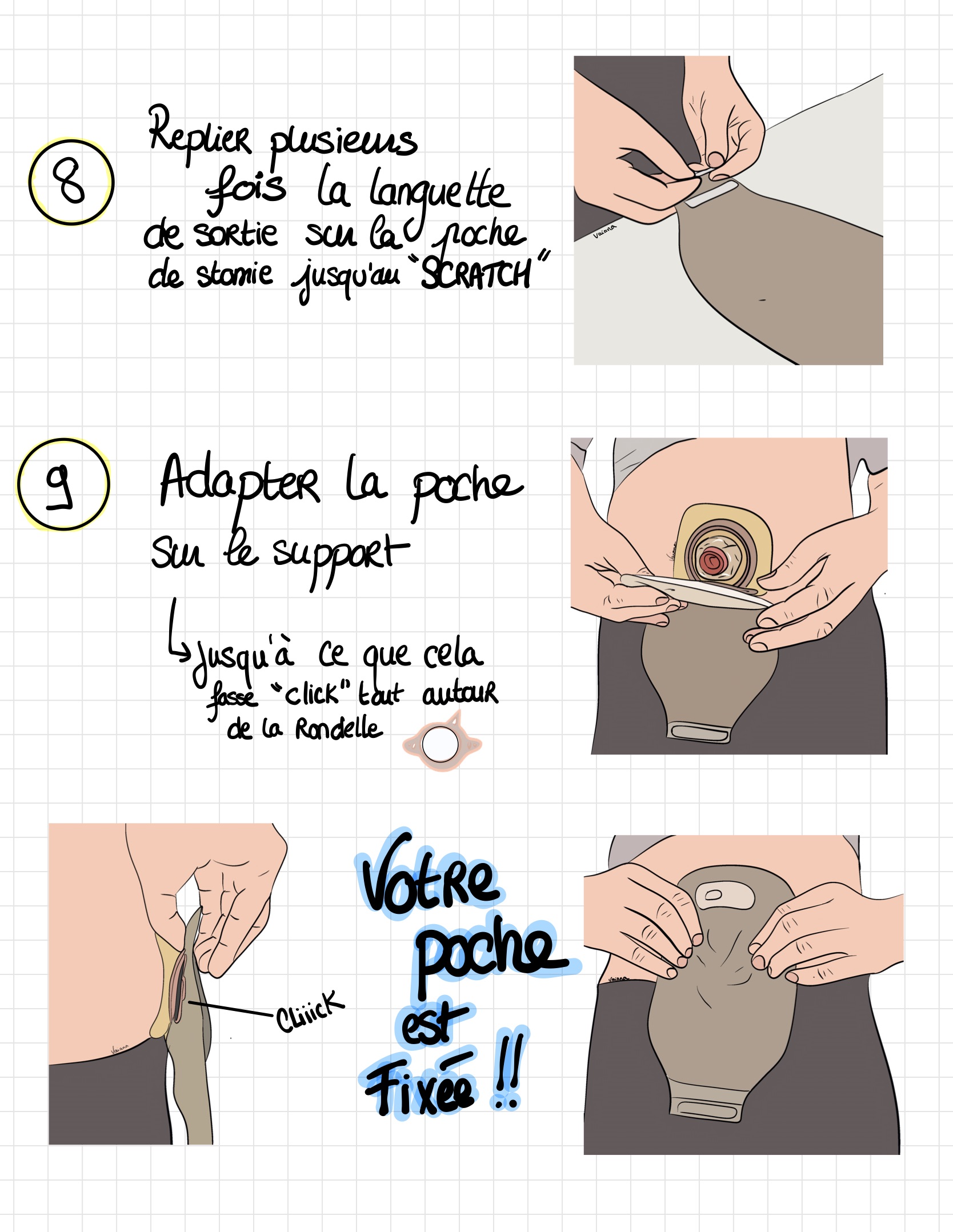 Livret ile ostomie 07