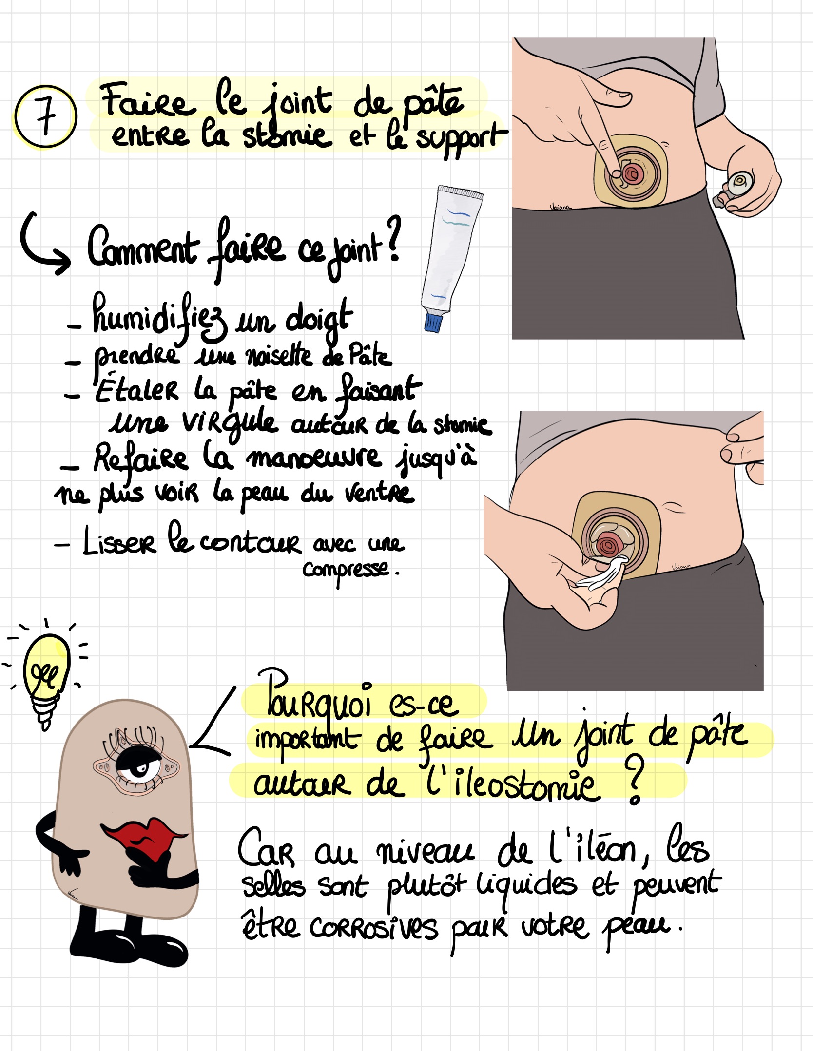Livret ile ostomie 06
