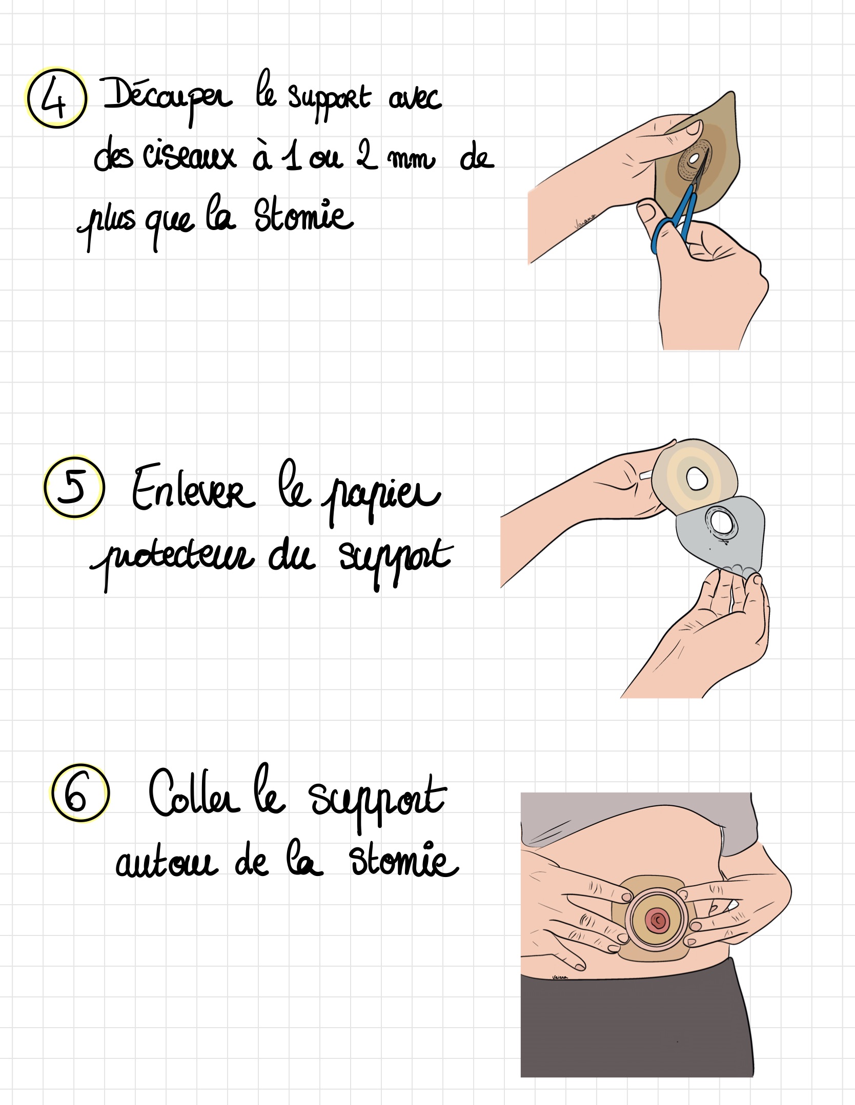 Livret ile ostomie 05