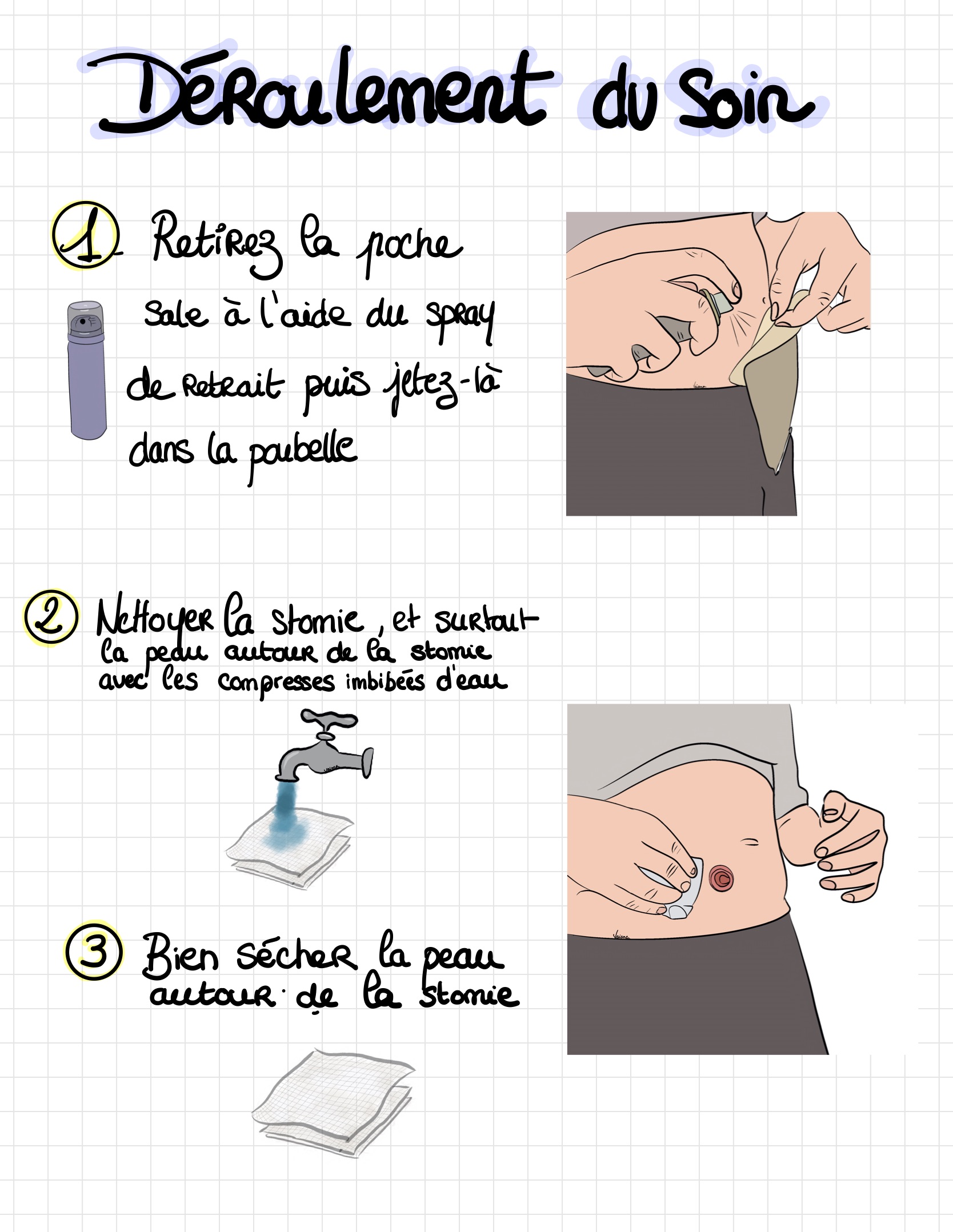 Livret ile ostomie 04
