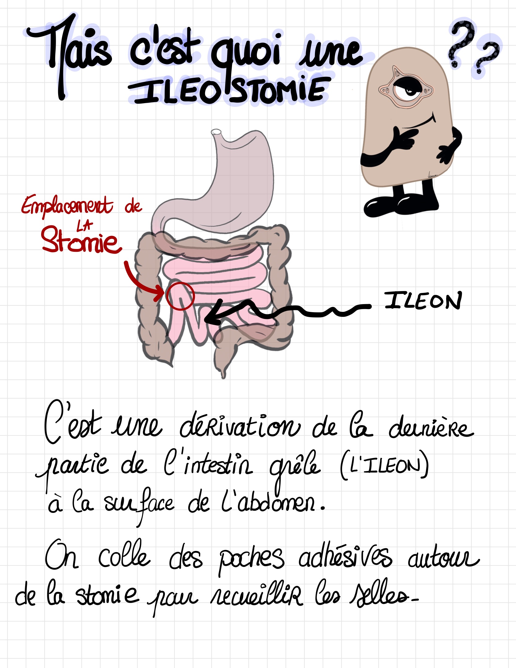 Livret ile ostomie 02