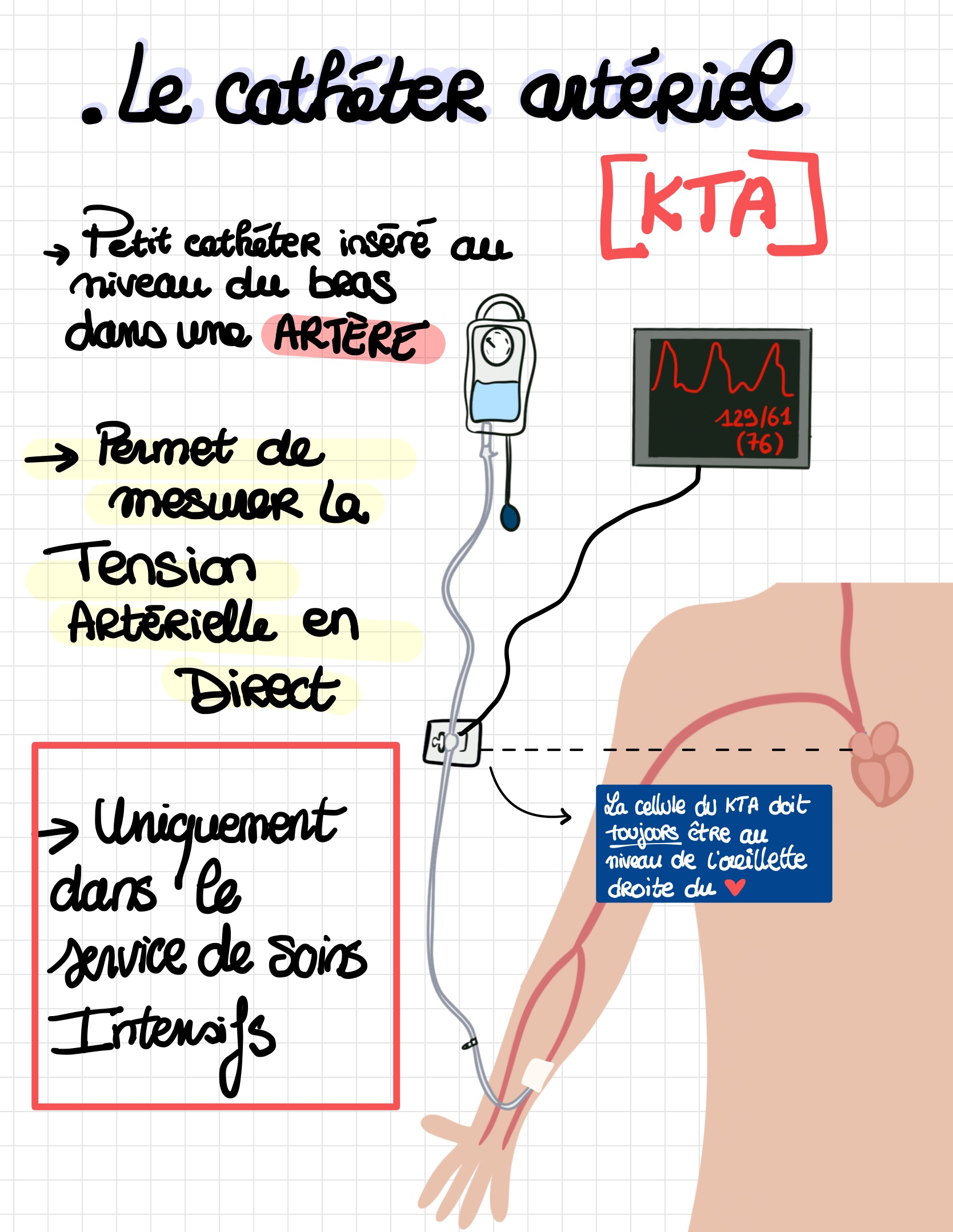 Les diffe rentes voies d abords vasculaires 7