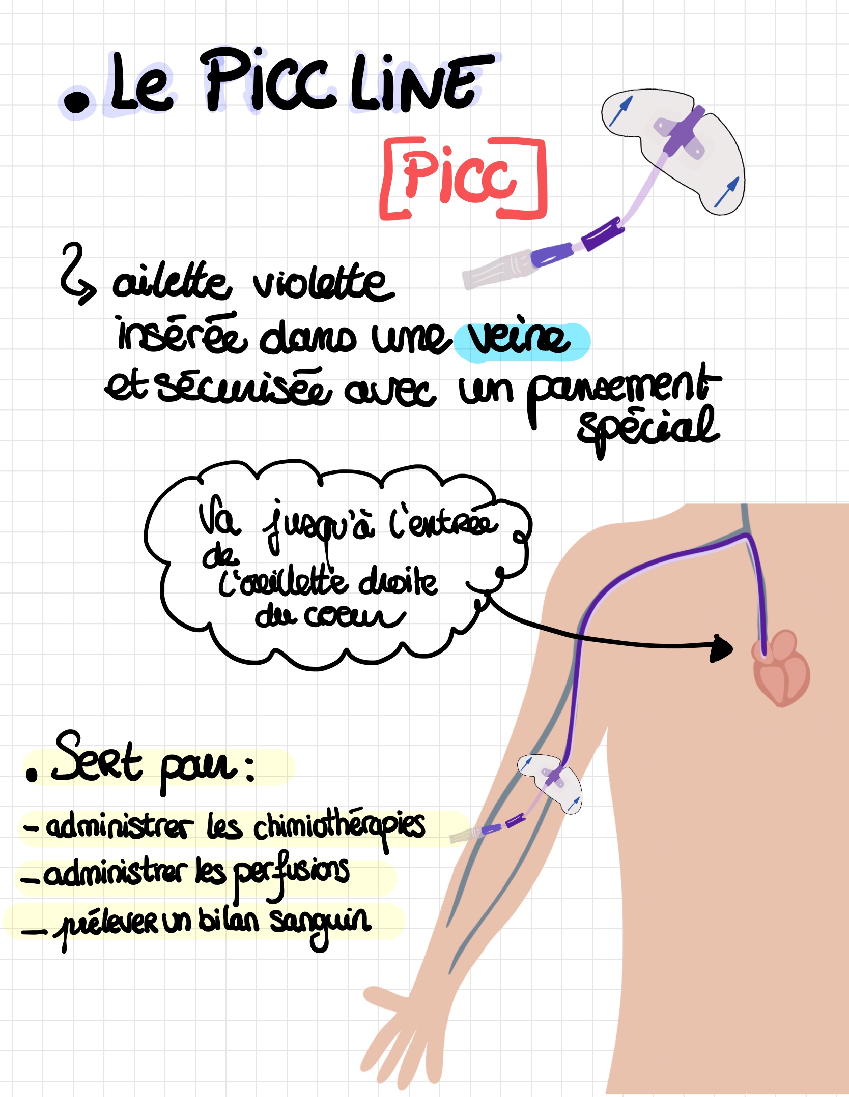 Les diffe rentes voies d abords vasculaires 5