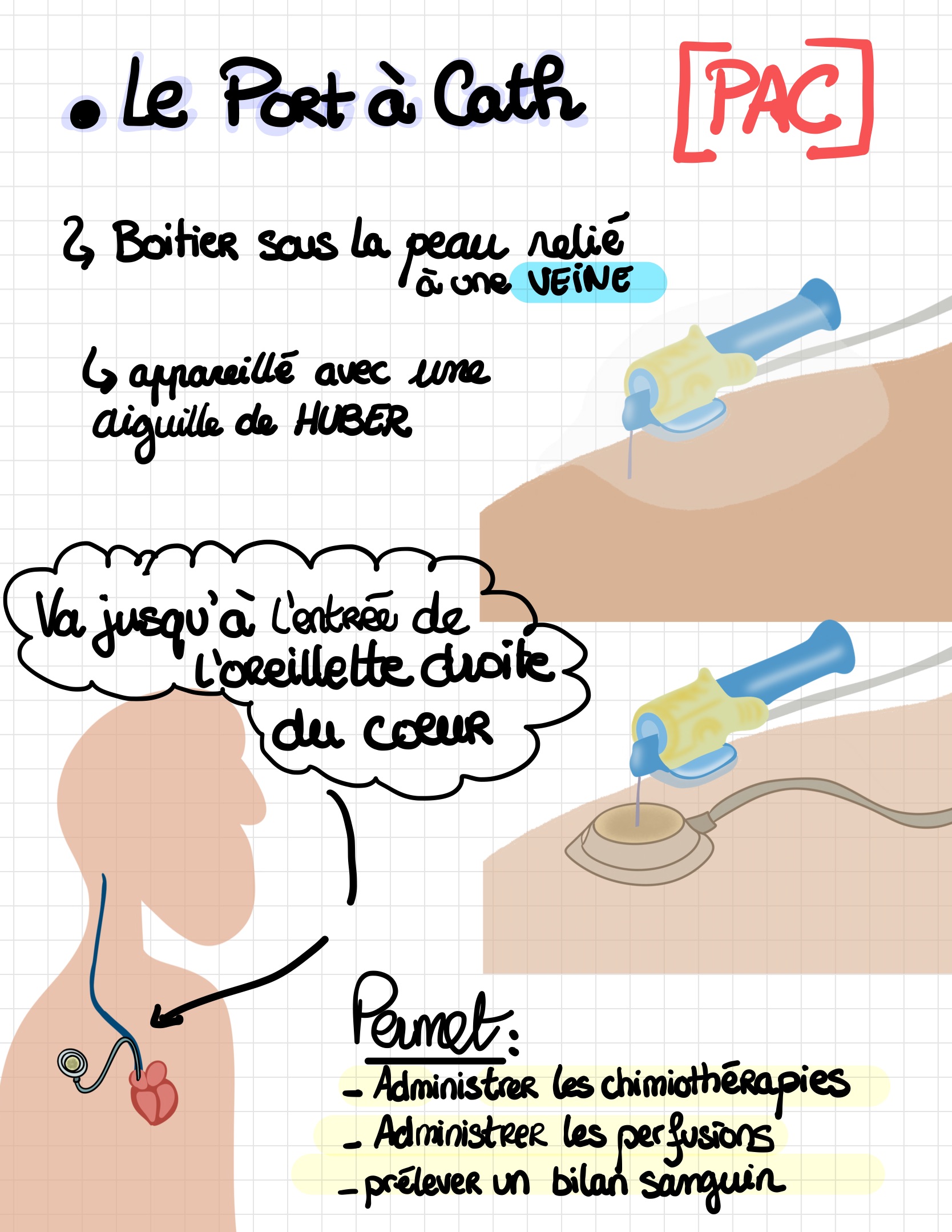 Les diffe rentes voies d abords vasculaires 4