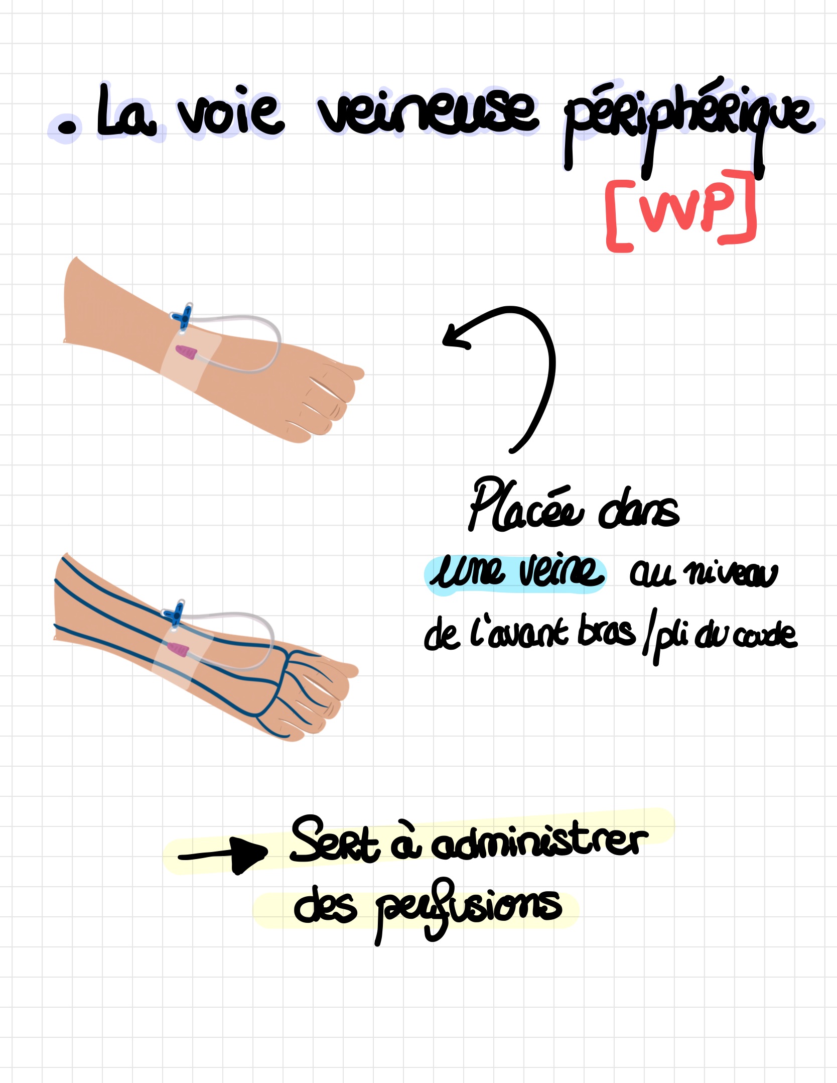 Les diffe rentes voies d abords vasculaires 2