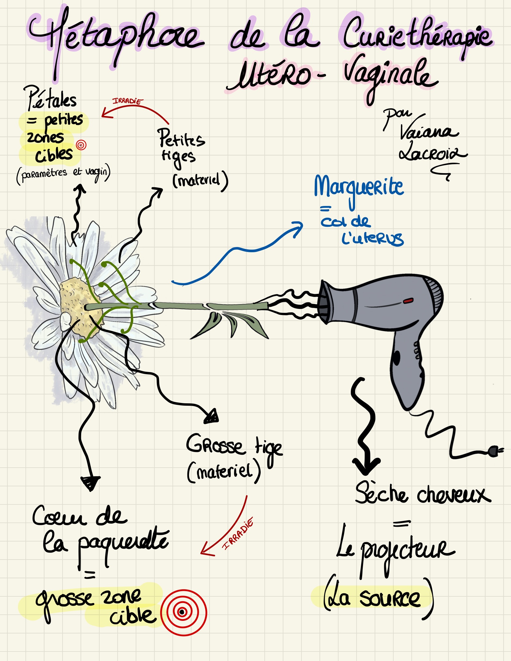 Me taphore curiethe rapie uterovaginale 1