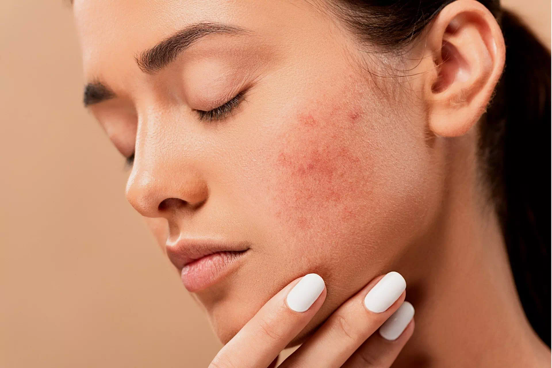 Le praticien Cécile Chabot Lyon Acupuncture propose des séances d'accupuncture efficaces pour les problèmes de peau, tels que l'acnée et l'eczéma.