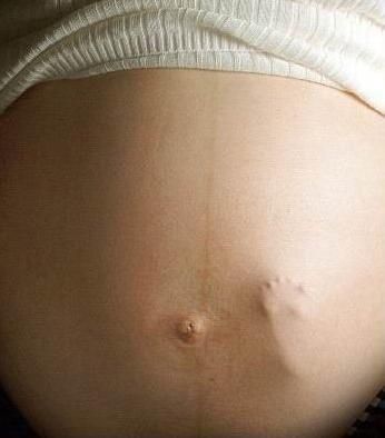 La femme enceinte et la réflexologie