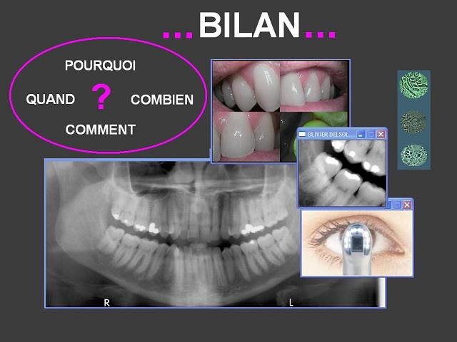 Bilan-pastel