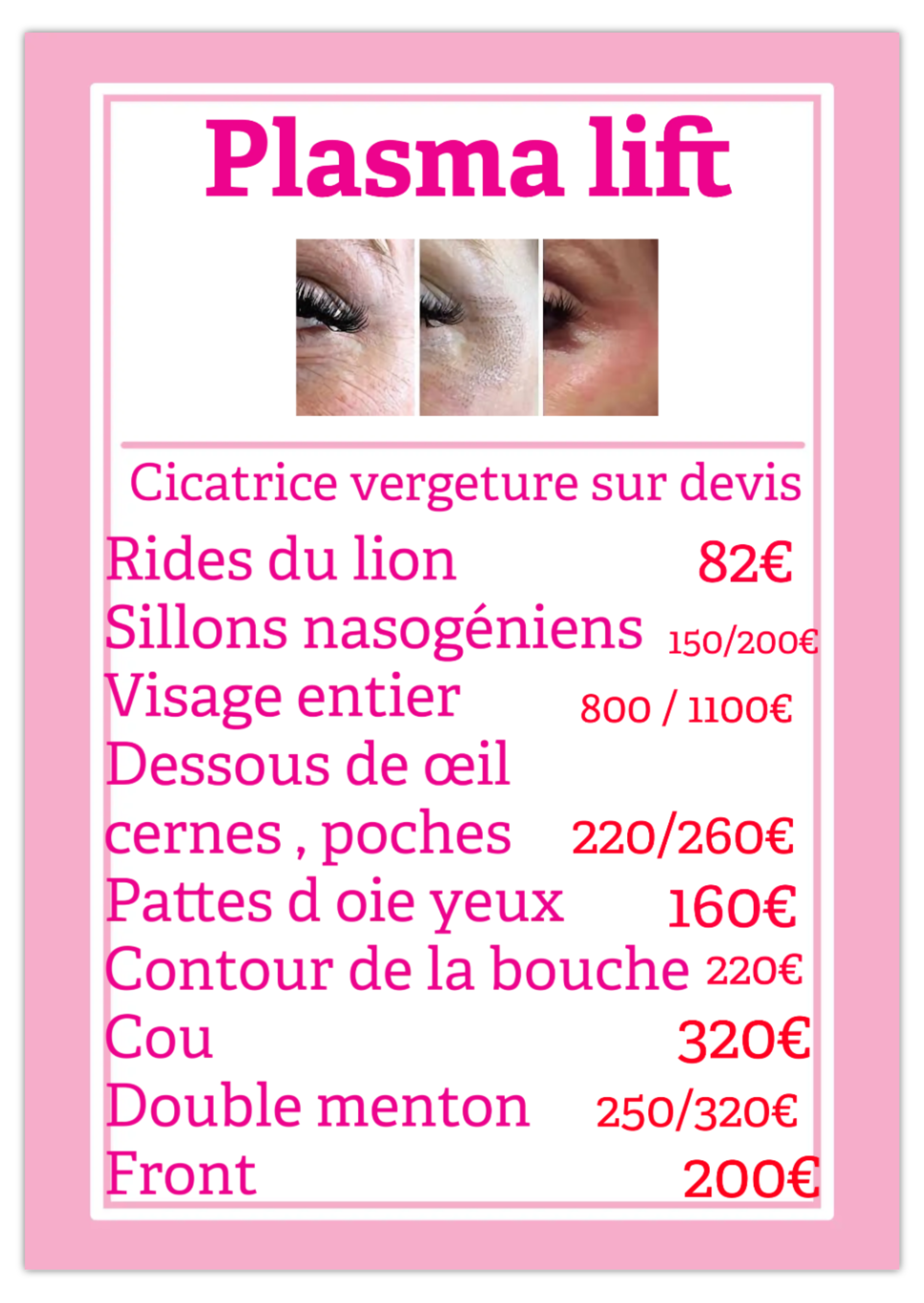 Telechargement