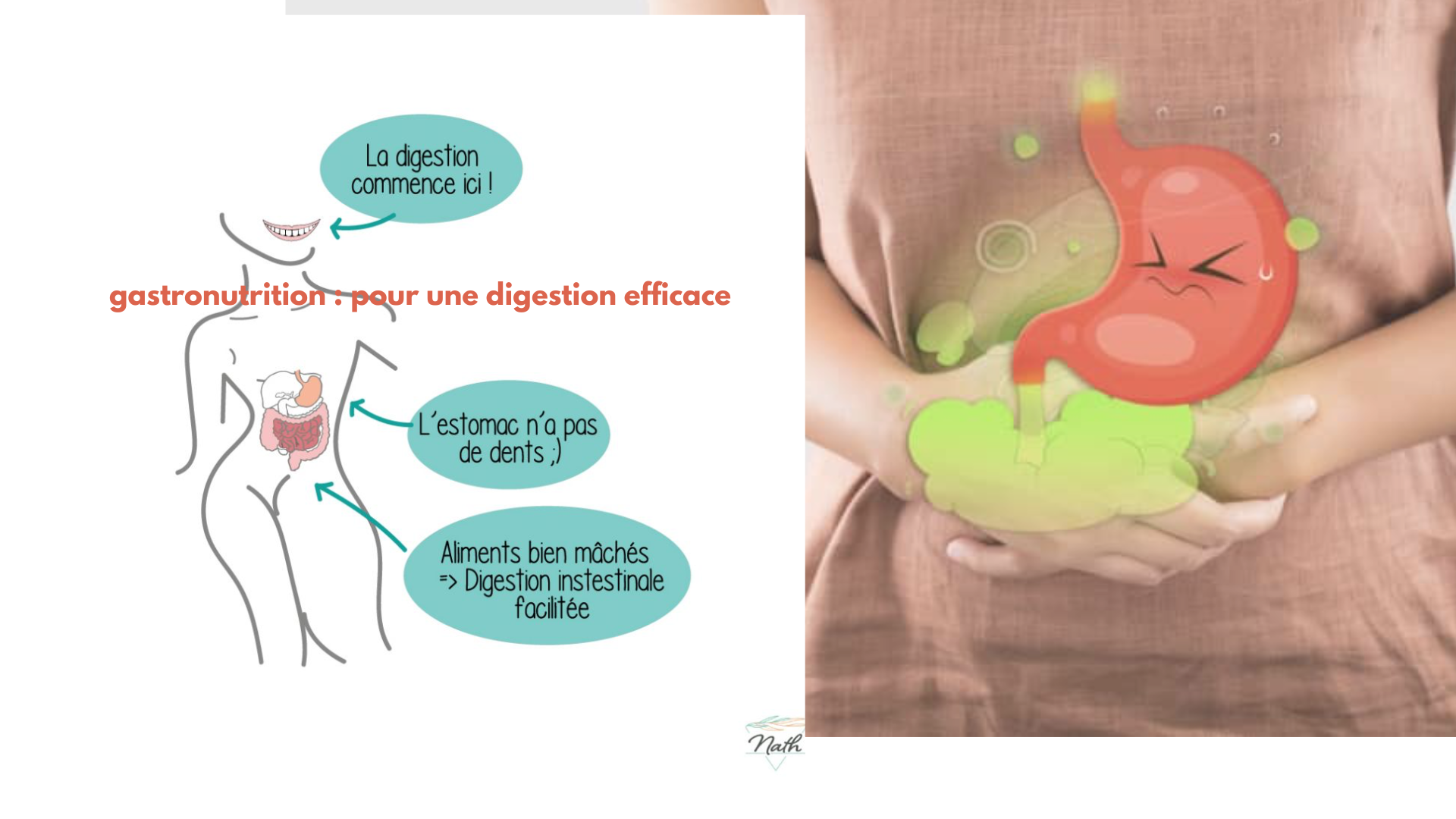 🩺 Clara et la gastronutrition : dyspepsie et intestin irritable