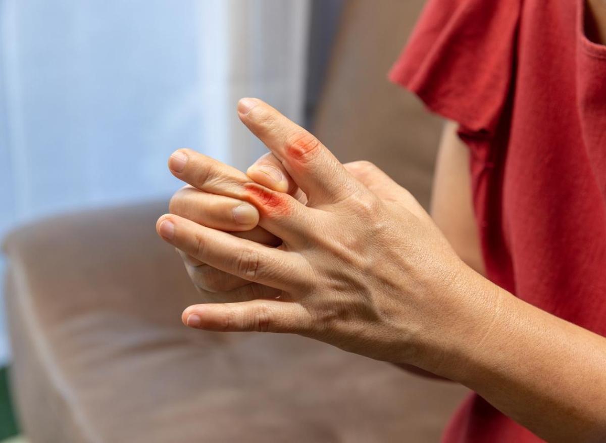 Polyarthrite rhumatoïde et stress post traumatique 