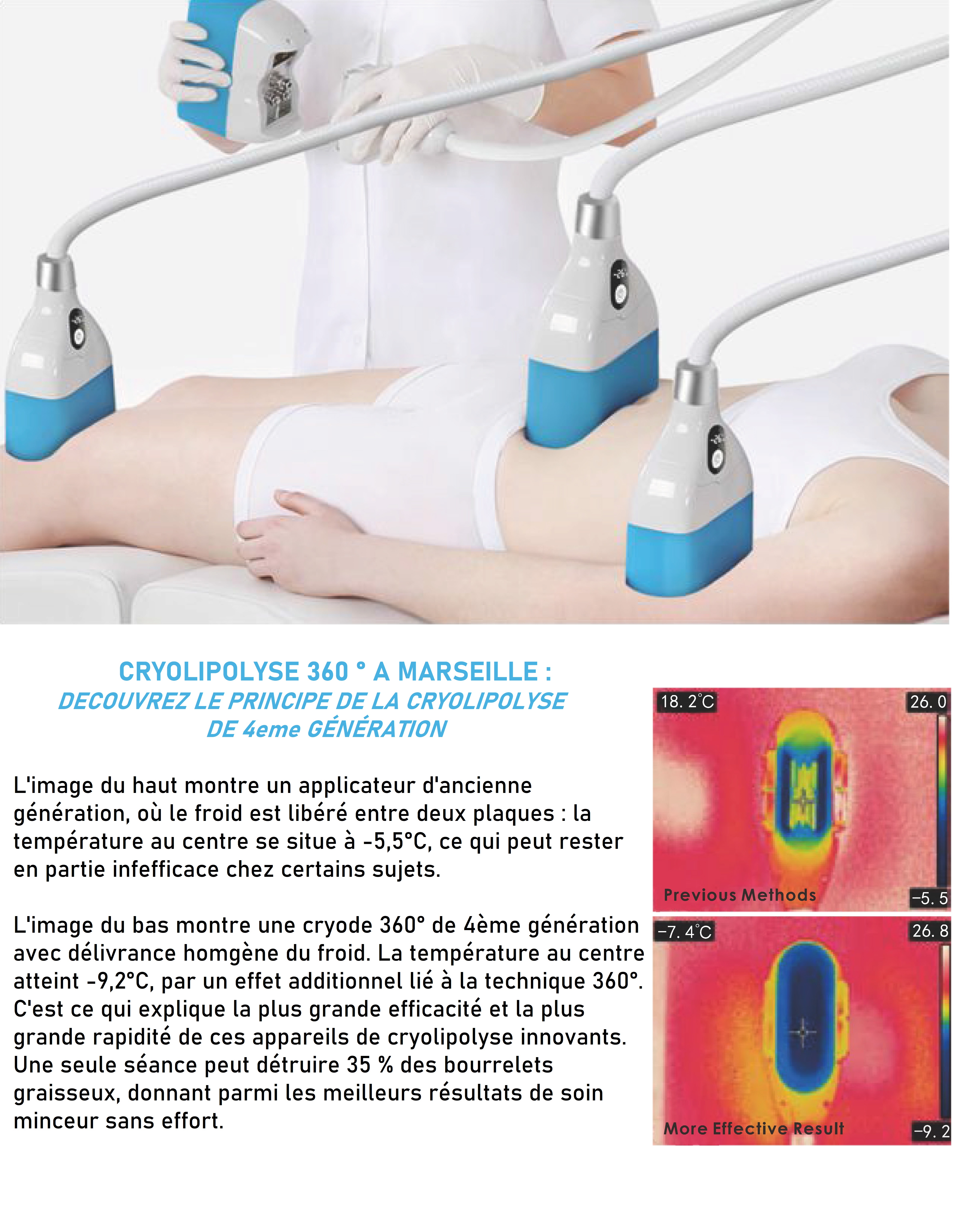 cryolipolyse pour perdre du ventre marseille allauch plan de cuques centre minceur