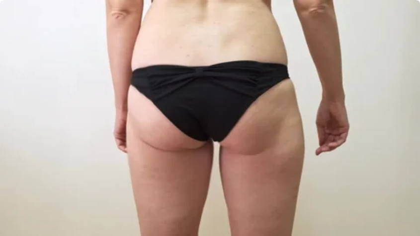 centre minceur anti cellulite pas cher marseille 13013 allauch plan de cuques la rose la valentine cassis