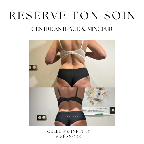 Copie de reserve ton soin copie