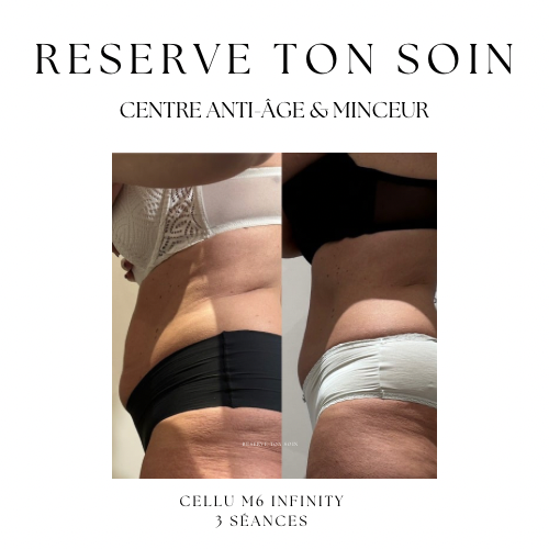 Copie de reserve ton soin