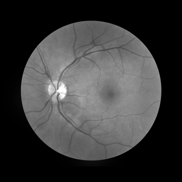 16 j 1 eau oeil terre left