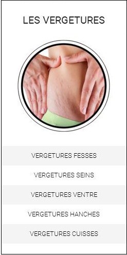 Vergetures