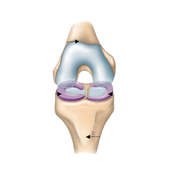 Chirurgie cartillagineuse3