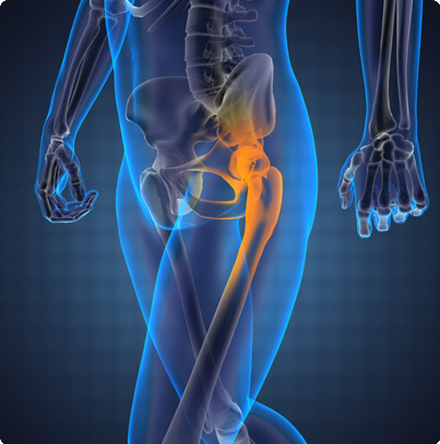Intervention chirurgie hanche